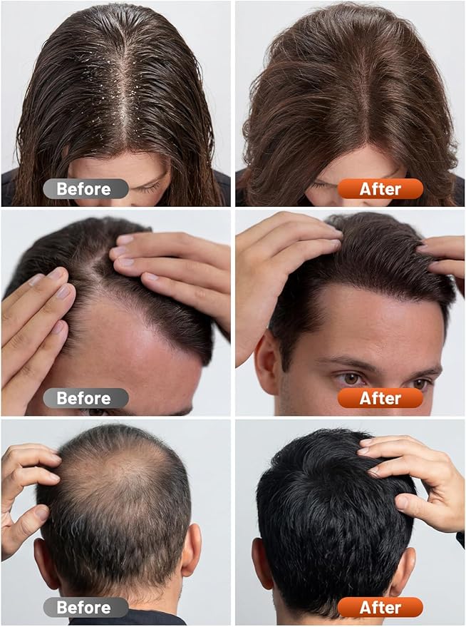 Regrow Thicker Hair Fast With Medical-Grade Red Light Therapy