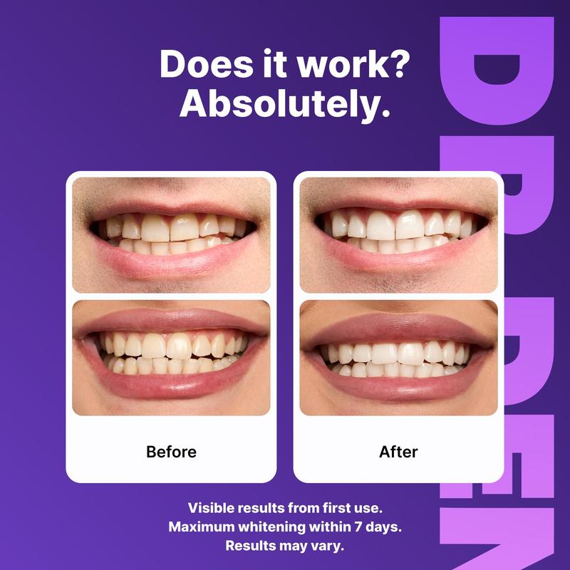Peroxide-Free Purple Teeth Whitening Strips (21 Sessions) – Safe for Sensitive Teeth