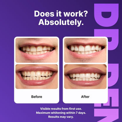 Peroxide-Free Purple Teeth Whitening Strips (21 Sessions) – Safe for Sensitive Teeth