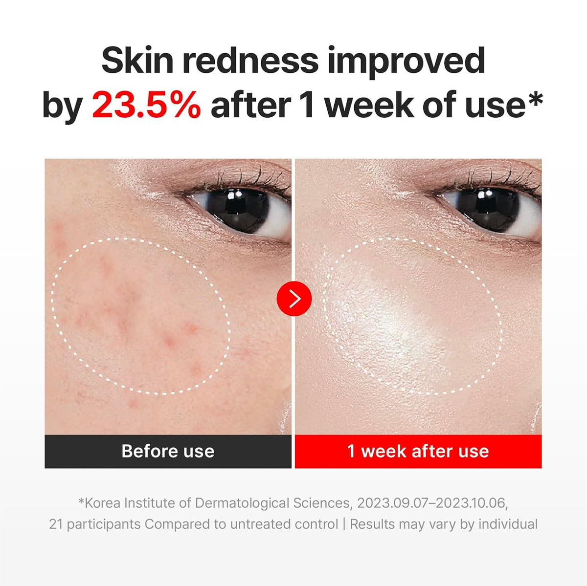 TECA-Infused Time Reverse Recovery Face Cream