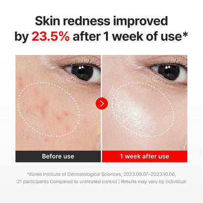 TECA-Infused Time Reverse Recovery Face Cream