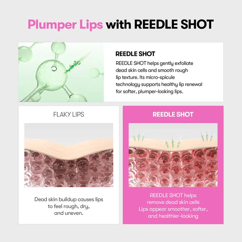 Get Your Dream Pout in Seconds: The Viral Microneedle Lip Plumper